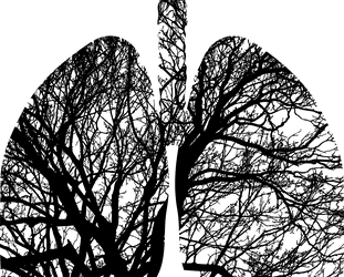 Cancer du poumon : google créé une intelligence artificielle capable de le détecter